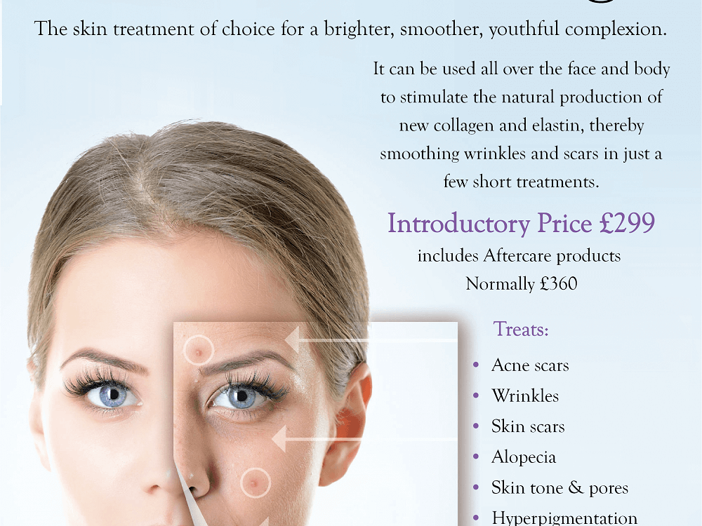 Microneedling Explained